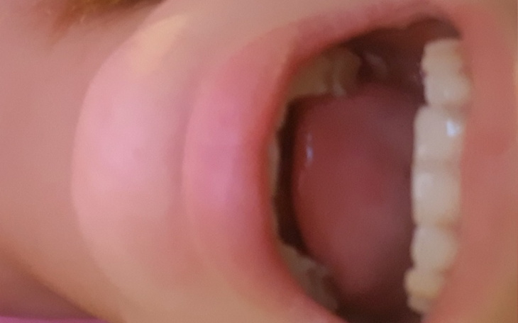 Zbiórka Kanałowe zębów leczenie - zdjęcie główne