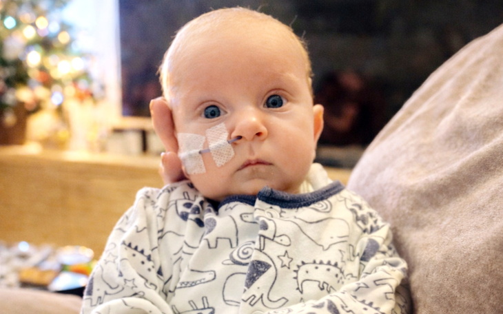 Małe dziecko z opatrunkiem na twarzy, patrzące w obiektyw.