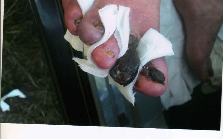 Zbiórka Na ciężko chorą osobe - zdjęcie główne