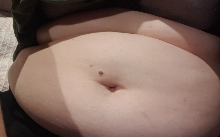 Zbiórka Okropny brzuch - zdjęcie główne