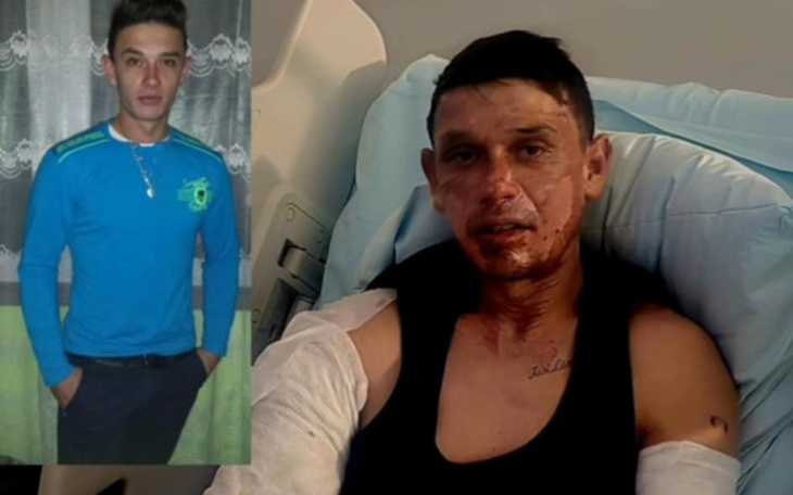 Mężczyzna z obrażeniami na twarzy w szpitalu.