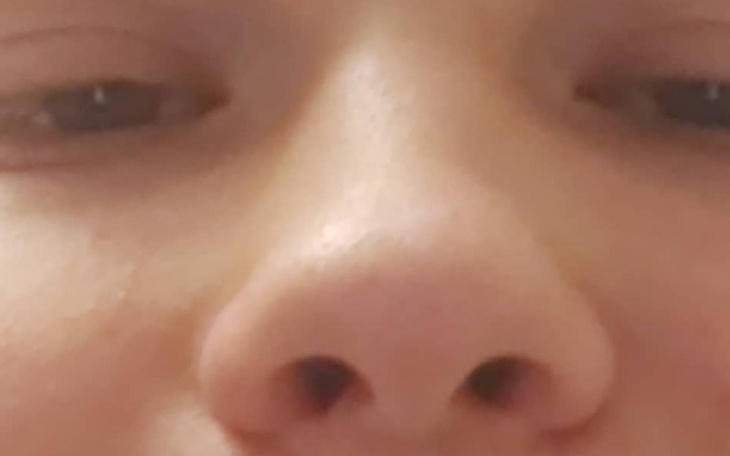 Zbiórka Na remont zagrzybiałego pokoju3 - zdjęcie główne