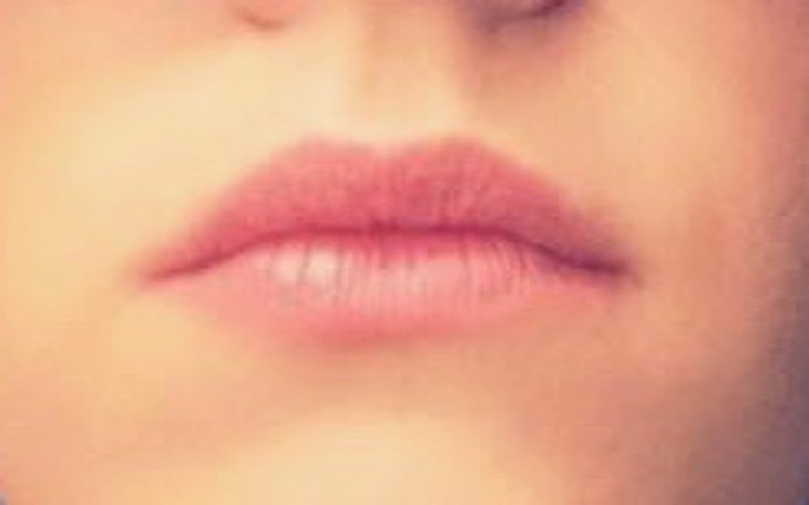 Zbiórka Odzyskać uśmiech... - zdjęcie główne