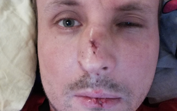 Zbiórka Pobity za wspieranie praw kobiet - zdjęcie główne