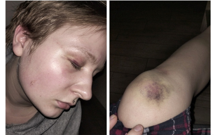 Zbiórka Pomoc finansowa po wypadku - zdjęcie główne