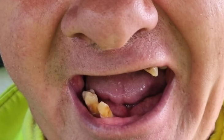 Zbiórka Mam 53 lata zbieram na ZĘBY - zdjęcie główne