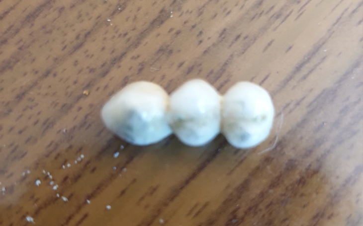 Zbiórka Zbieram na implanty szczękowe - zdjęcie główne