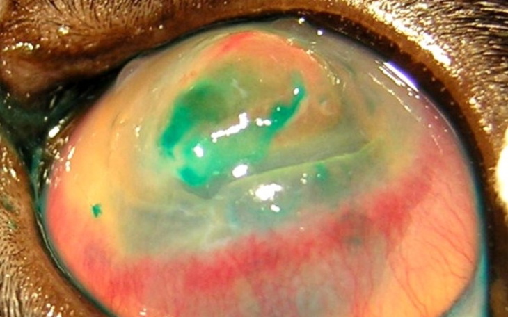 Zbiórka Przeszczep rogówki oka - zdjęcie główne