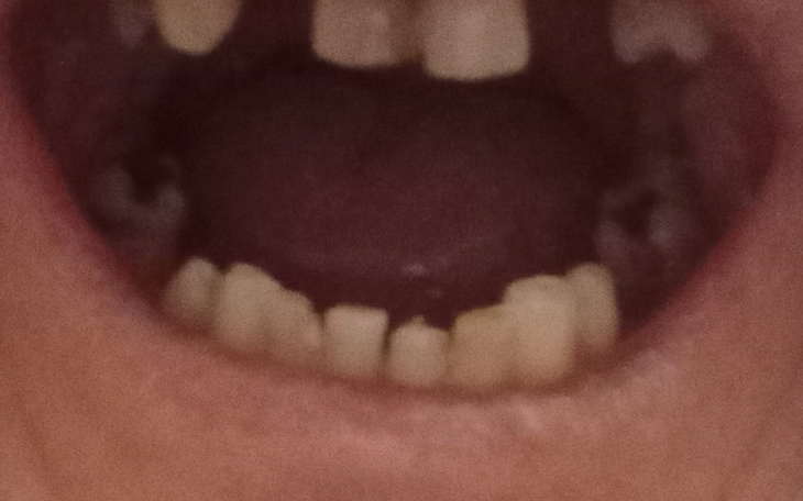 Zbiórka Na leczenie zębów w nowym zyciu - zdjęcie główne