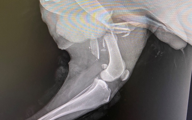 Rentgen pokazujący złamaną kość.