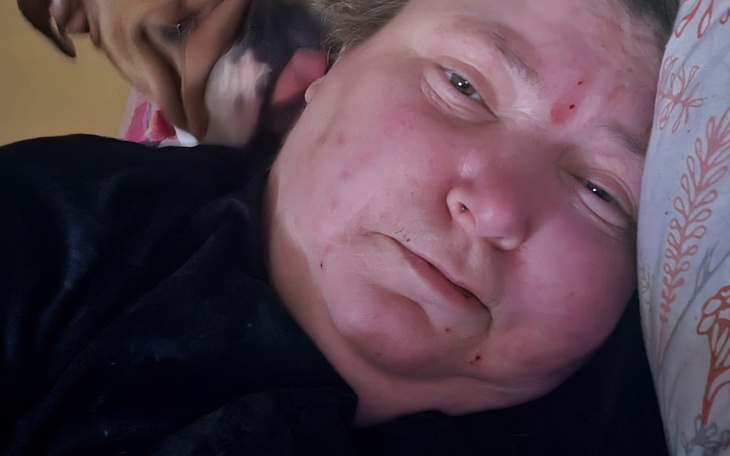 Kobieta leżąca na łóżku, z psem przy uchu, wygląda na zmęczoną.