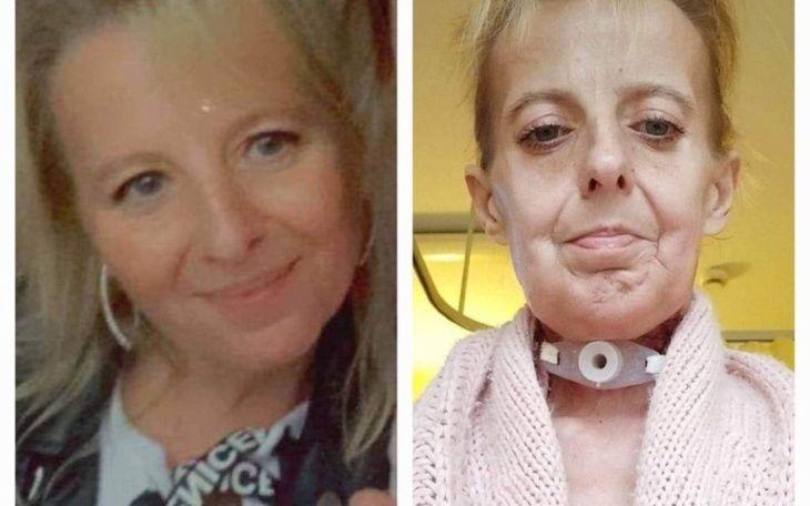 Zbiórka Pomoc dla Edzi. - zdjęcie główne