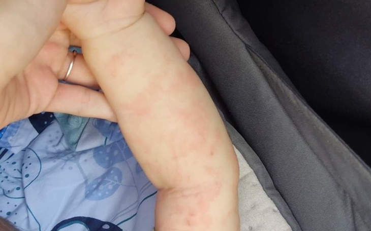Zbiórka Testy alergiczne dla dziecka - zdjęcie główne