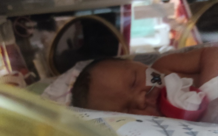 Zbiórka Rehabilitacja dla Agatki - zdjęcie główne