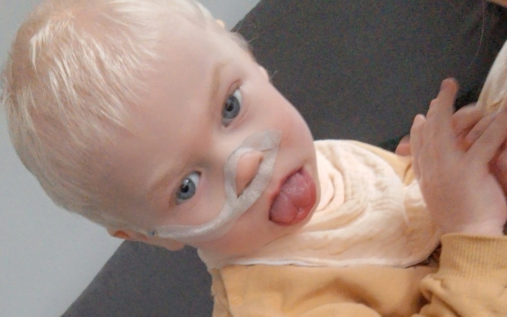 Chłopiec z rurką tlenową, uśmiechający się do kamery.