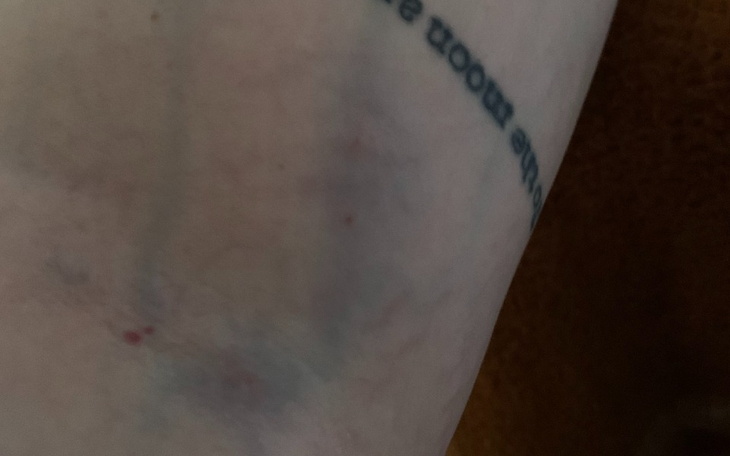 Zbiórka Paulina potrzebuje naszej pomocy - zdjęcie główne