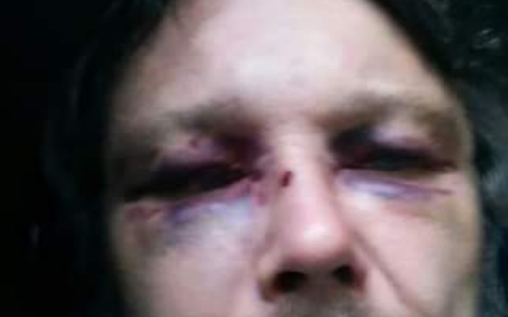 Zbiórka Komornik sądowy spłata - zdjęcie główne