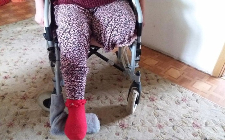 Zbiórka P.Ania po amputacji nogi - zdjęcie główne