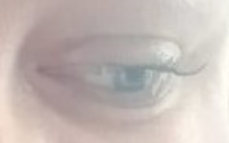 Zbiórka Proaktywna schizofreniczka - zdjęcie główne