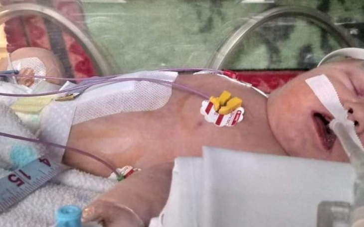 Noworodek w inkubatorze, otoczony sprzętem medycznym.