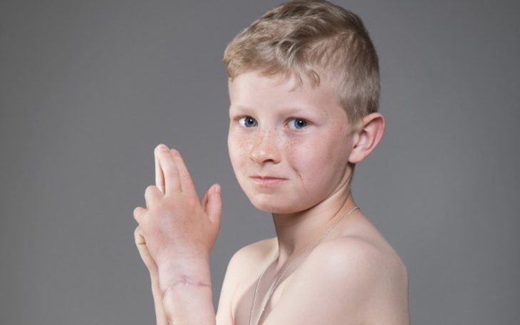 Zbiórka Gracjan pogryziony przez psa - zdjęcie główne