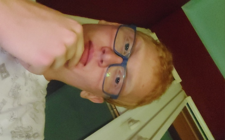 Zbiórka Operacja plastyczna puchy Radka - zdjęcie główne