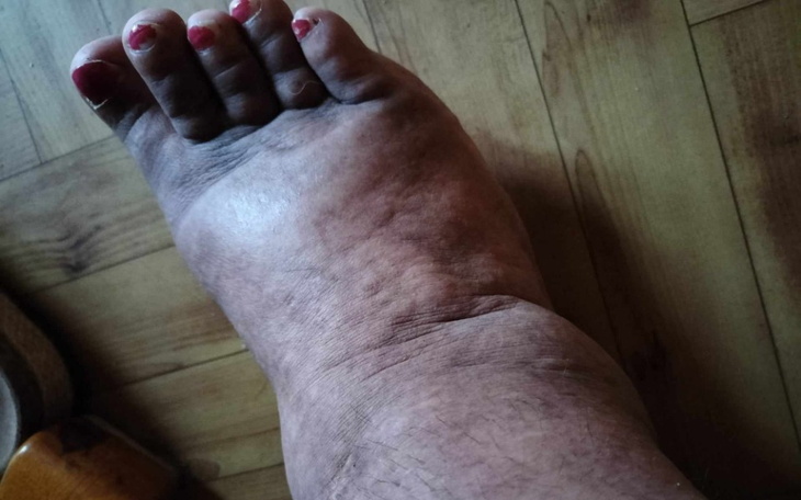 Zbiórka Operacja na zespół sudeka - zdjęcie główne