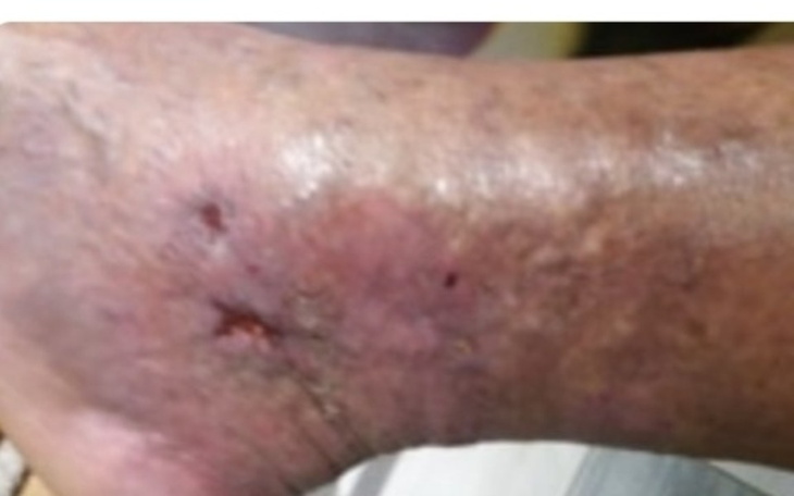 Zbiórka Na operacje - błagam o pomoc - zdjęcie główne