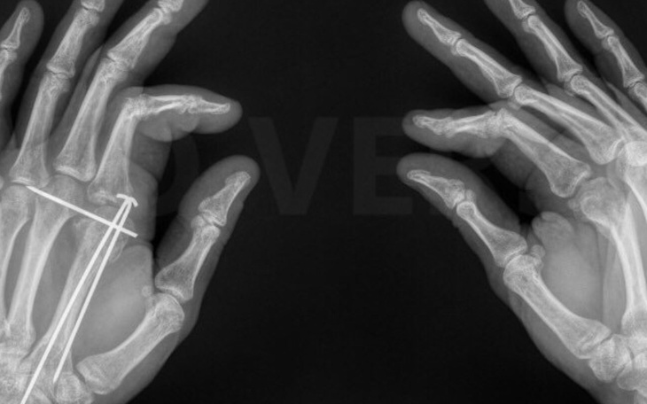 Zbiórka Na odzyskanie władzy w dłoniach - zdjęcie główne