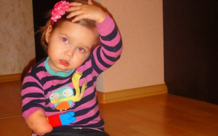 Zbiórka Maleńka Jadzia zbiera na protezę - zdjęcie główne