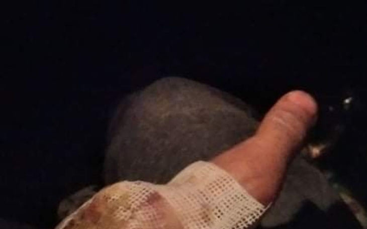 Zbiórka Dla kolegi na protezę ręki - zdjęcie główne