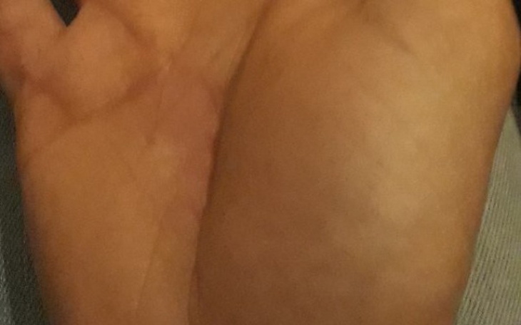 Zbiórka Na operacje dla Bartka - zdjęcie główne