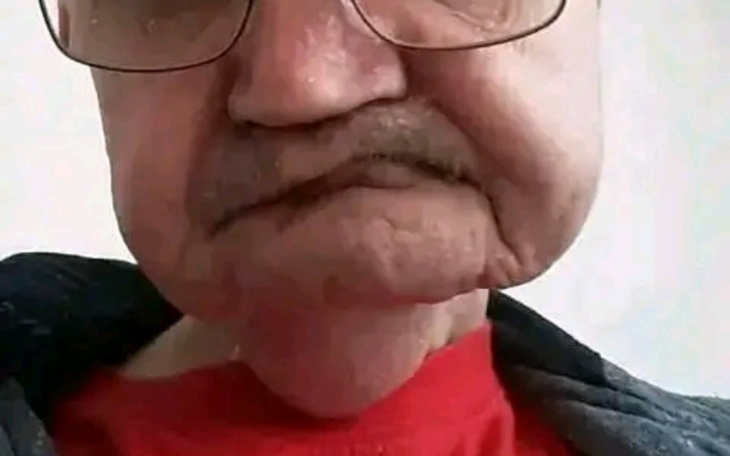 Zbiórka Leczenie/zmiana leczenia - zdjęcie główne