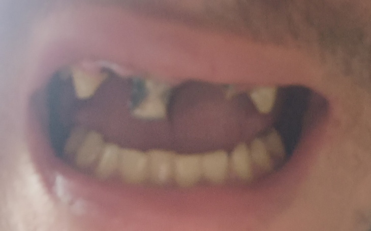 Zbiórka Lepszy uśmiech leczenie zębów - zdjęcie główne