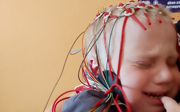 Dziecko z elektrodami na głowie, wyrażające emocje.