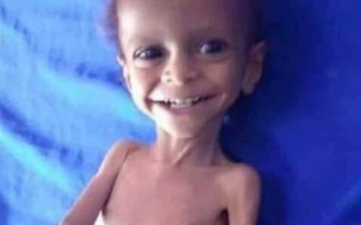 Zbiórka Zbiorka dla YEMENU - zdjęcie główne