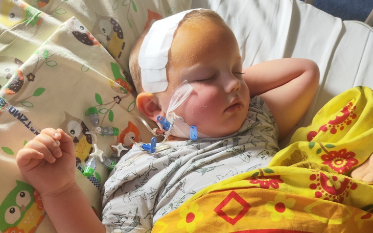 Małe dziecko śpiące w szpitalu z opatrunkiem na głowie.