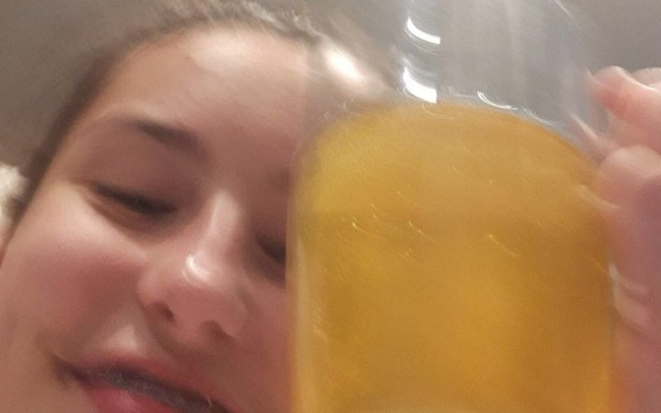 Zbiórka Na operacje plastyczną ryja - zdjęcie główne