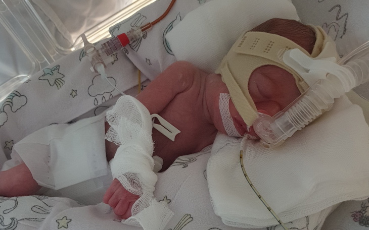 Noworodek w inkubatorze z rurkami tlenowymi.