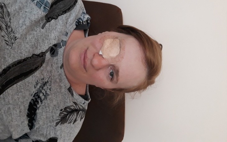 Zbiórka NA Start Ani Implant oka. - zdjęcie główne