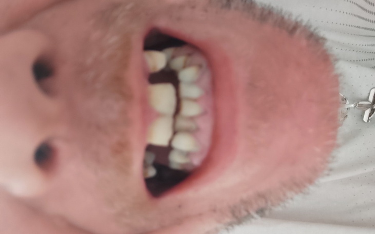 Zbiórka Nowy uśmiech na urodziny - zdjęcie główne