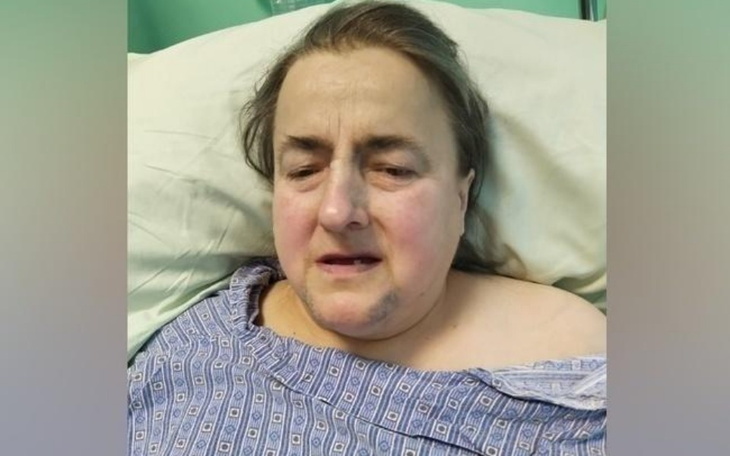 Zbiórka Leczenie, rehabilitacja i powrót - zdjęcie główne