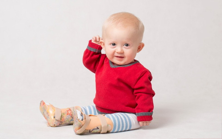 Zbiórka Leczenie i rehabilitacja Teosia. - zdjęcie główne