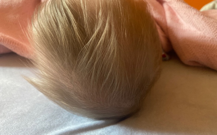 Zbiórka Terapia kaskowa dla Mirka - zdjęcie główne