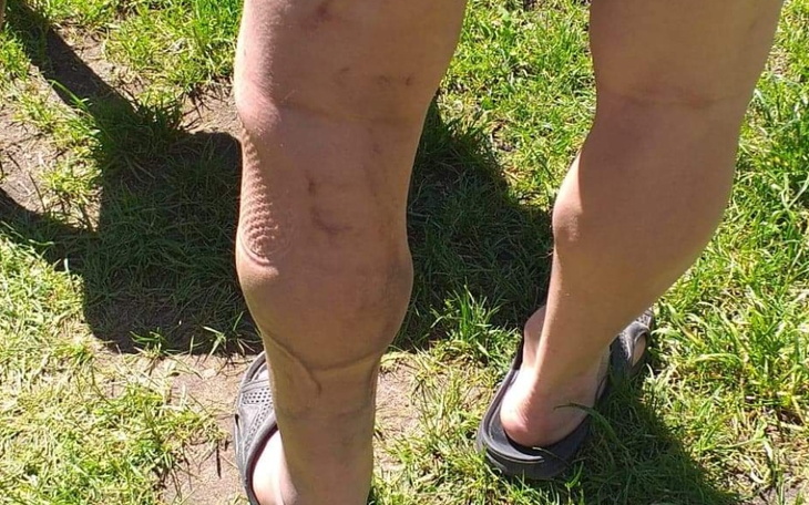 Zbiórka Operacja nogi i sciegna - zdjęcie główne