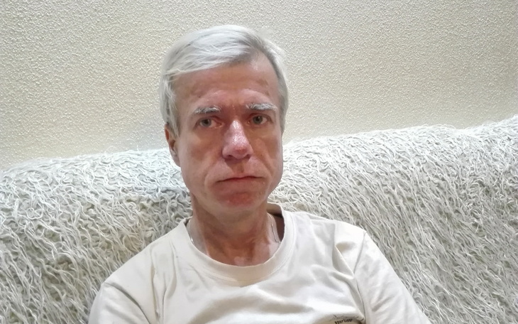 Zbiórka Pomóż pokonać mi raka - zdjęcie główne