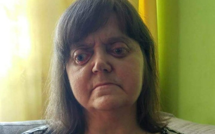 Zbiórka Zbjorka na lek Vemurafenib - zdjęcie główne