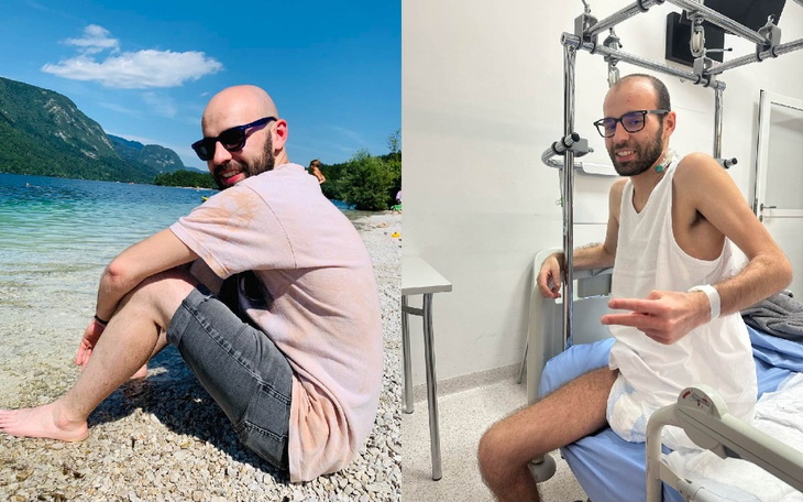 Zbiórka Proteza dla Krzyśka - zdjęcie główne