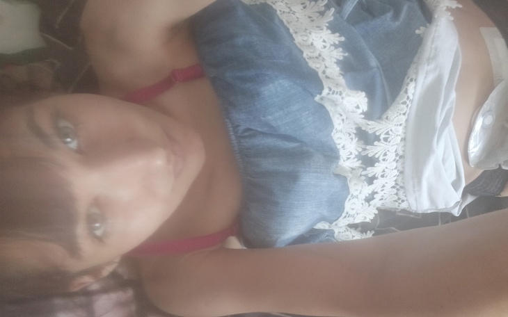 Zbiórka Pomoc dla Jessici - zdjęcie główne