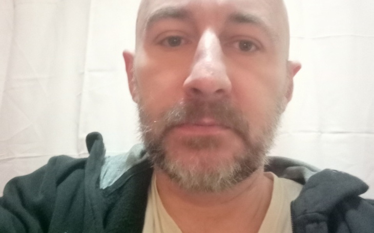 Zbiórka Wstawienie uzębienia po wypadku - zdjęcie główne